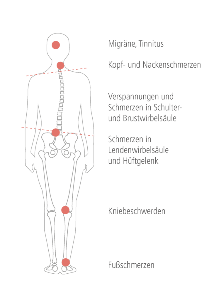 CMD Funktionsanalyse